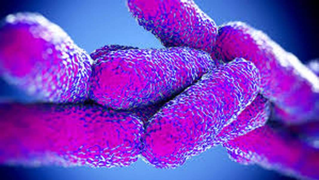 legionella.jpg